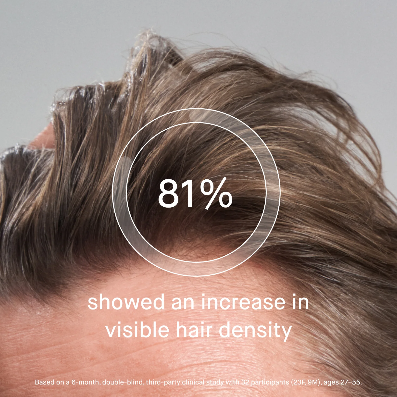 OS-01 HAIR SCALP SERUM - Image 4