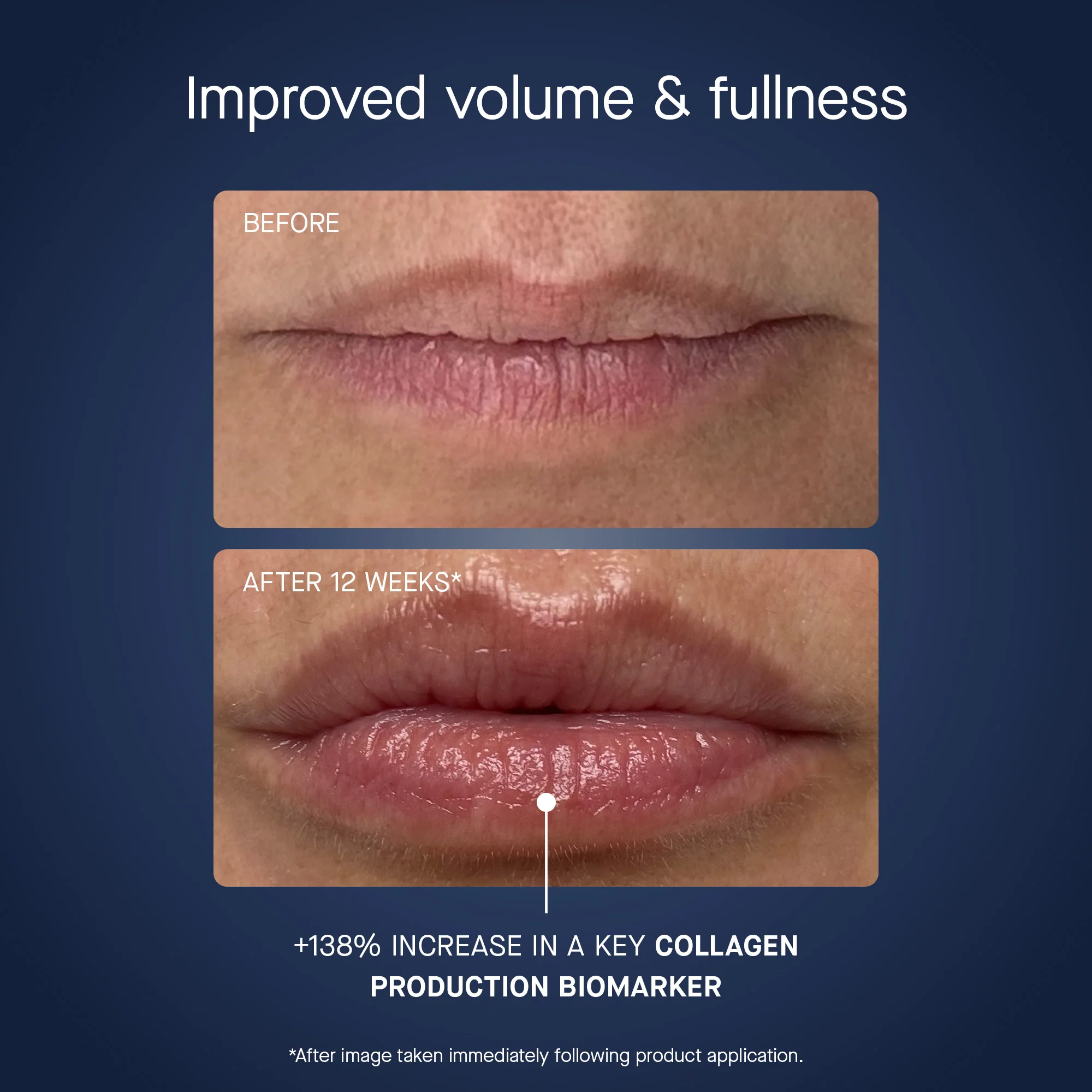 OS-01 LIP MASK - Image 3